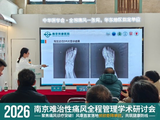 2026 南京难治性痛风全程管理学术研讨会圆满落幕 风康分享伏欣奇拜单抗首家落地临床成果429.png